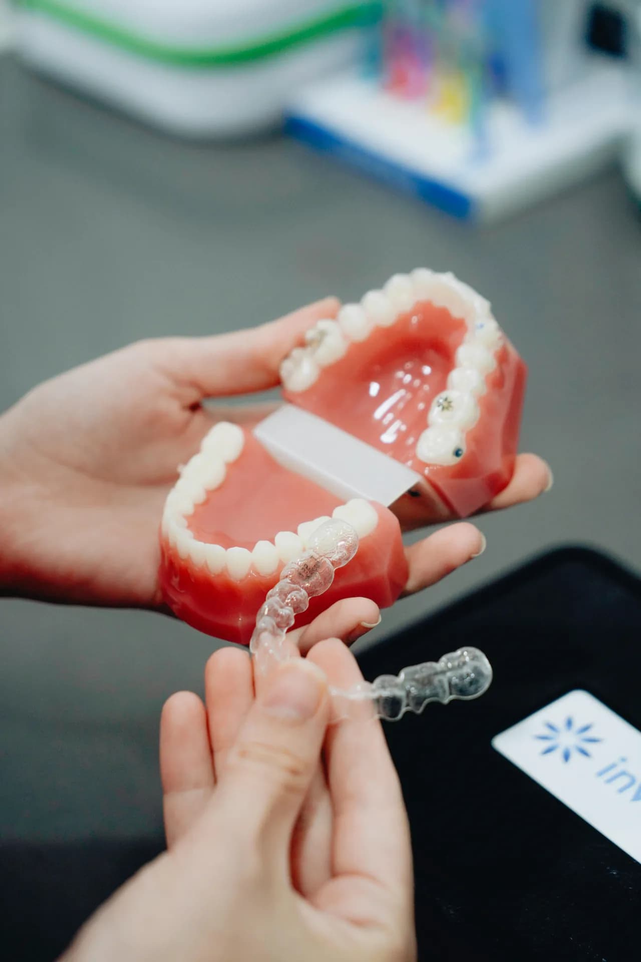 Transparente Invisalign-Schiene auf einem Zahnmodell